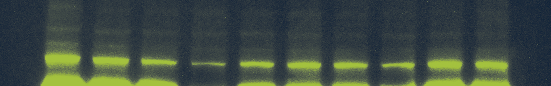 Close-up view of a Western blot lab test. Ten green ovals form a line at the bottom. The notations read "-130" and "-100."