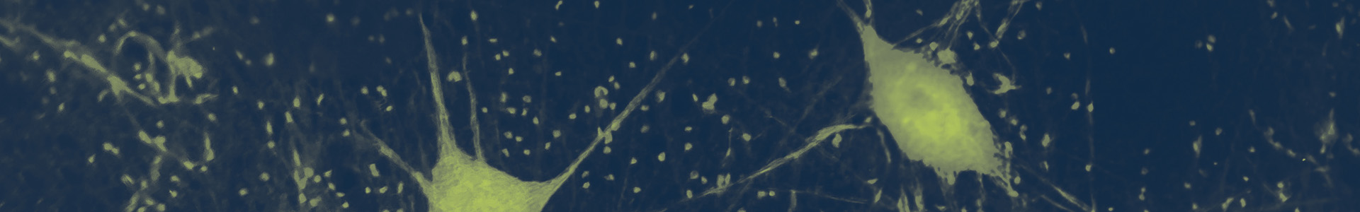 Microscopic view of neurons, colored bright green to contrast against a navy blue backdrop.